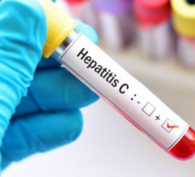 <i><b>Azərbaycanda hepatit statistikası -<font color=red> Son rəqəmlər</b></i></font>